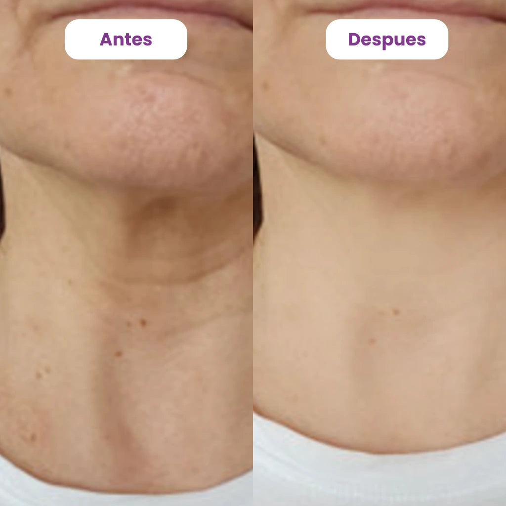 PROMO -50%: Go Pure Neck Cream 🌿